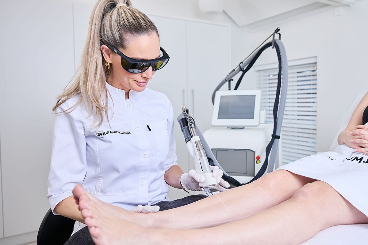 Laser ontharen: wat je echt moet weten voordat je begint